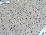 HECW1 Antibody in Immunohistochemistry (Paraffin) (IHC (P))