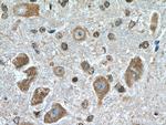 HECW1 Antibody in Immunohistochemistry (Paraffin) (IHC (P))