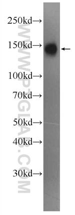 SFRS8 Antibody in Western Blot (WB)