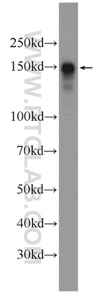 SFRS8 Antibody in Western Blot (WB)
