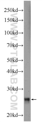RNF151 Antibody in Western Blot (WB)