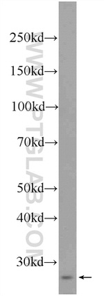 RNF151 Antibody in Western Blot (WB)