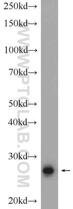 RNF151 Antibody in Western Blot (WB)