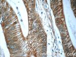 BEND4 Antibody in Immunohistochemistry (Paraffin) (IHC (P))