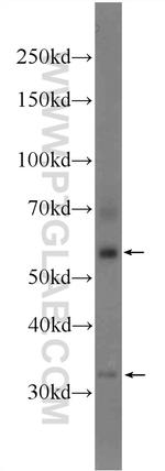 BEND4 Antibody in Western Blot (WB)