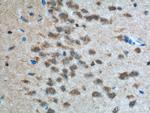 PVRL1 Antibody in Immunohistochemistry (Paraffin) (IHC (P))