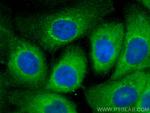 PFAS Antibody in Immunocytochemistry (ICC/IF)
