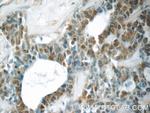YEATS2 Antibody in Immunohistochemistry (Paraffin) (IHC (P))