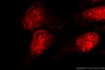 MDC1 Antibody in Immunocytochemistry (ICC/IF)
