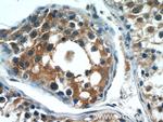 C14orf138 Antibody in Immunohistochemistry (Paraffin) (IHC (P))