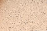 TRPC1 Antibody in Immunohistochemistry (Paraffin) (IHC (P))