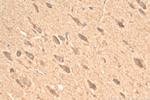 TRPC1 Antibody in Immunohistochemistry (Paraffin) (IHC (P))