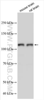 TRPC1 Antibody in Western Blot (WB)