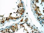 ODF1 Antibody in Immunohistochemistry (Paraffin) (IHC (P))