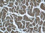 ILVBL Antibody in Immunohistochemistry (Paraffin) (IHC (P))