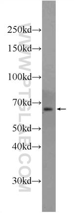 ILVBL Antibody in Western Blot (WB)