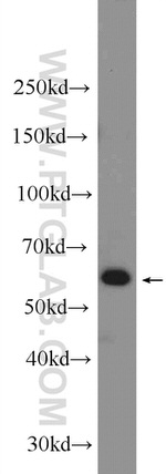 ILVBL Antibody in Western Blot (WB)