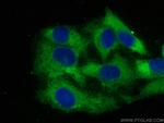 YTHDF2 Antibody in Immunocytochemistry (ICC/IF)