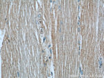 YTHDF2 Antibody in Immunohistochemistry (Paraffin) (IHC (P))