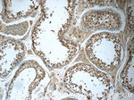 YTHDF2 Antibody in Immunohistochemistry (Paraffin) (IHC (P))