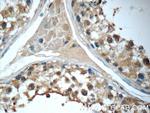 YTHDF2 Antibody in Immunohistochemistry (Paraffin) (IHC (P))