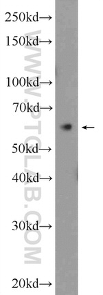 YTHDF2 Antibody in Western Blot (WB)