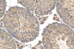 FAM8A1 Antibody in Immunohistochemistry (Paraffin) (IHC (P))
