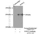 WWC2 Antibody in Immunoprecipitation (IP)