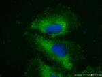 ZNF573 Antibody in Immunocytochemistry (ICC/IF)