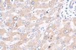 ZNF573 Antibody in Immunohistochemistry (Paraffin) (IHC (P))