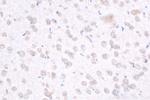 ZNF573 Antibody in Immunohistochemistry (Paraffin) (IHC (P))