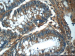 RPS6KL1 Antibody in Immunohistochemistry (Paraffin) (IHC (P))