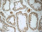 RPS6KL1 Antibody in Immunohistochemistry (Paraffin) (IHC (P))