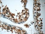 RPS6KL1 Antibody in Immunohistochemistry (Paraffin) (IHC (P))