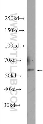 RPS6KL1 Antibody in Western Blot (WB)