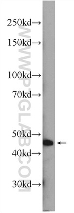 ZDHHC13 Antibody in Western Blot (WB)