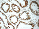 MUM1L1 Antibody in Immunohistochemistry (Paraffin) (IHC (P))