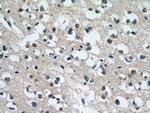 MUM1L1 Antibody in Immunohistochemistry (Paraffin) (IHC (P))