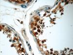 MUM1L1 Antibody in Immunohistochemistry (Paraffin) (IHC (P))