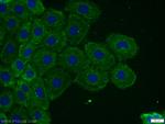 TOR1AIP2 Antibody in Immunocytochemistry (ICC/IF)