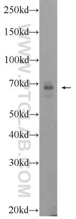 SCC4 Antibody in Western Blot (WB)