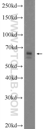 SCC4 Antibody in Western Blot (WB)