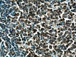 LRMP Antibody in Immunohistochemistry (Paraffin) (IHC (P))
