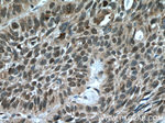 Caspase 2/p18 Antibody in Immunohistochemistry (Paraffin) (IHC (P))