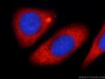 KLHL31 Antibody in Immunocytochemistry (ICC/IF)