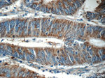 KLHL31 Antibody in Immunohistochemistry (Paraffin) (IHC (P))