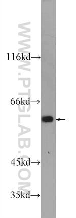 KLHL31 Antibody in Western Blot (WB)