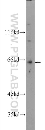 KLHL31 Antibody in Western Blot (WB)