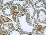 ANKS1B Antibody in Immunohistochemistry (Paraffin) (IHC (P))