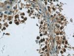 ANKS1B Antibody in Immunohistochemistry (Paraffin) (IHC (P))